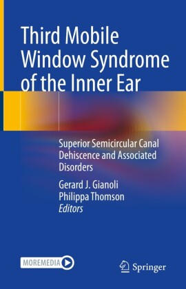 Third Mobile Window Syndrome of the Inner Ear