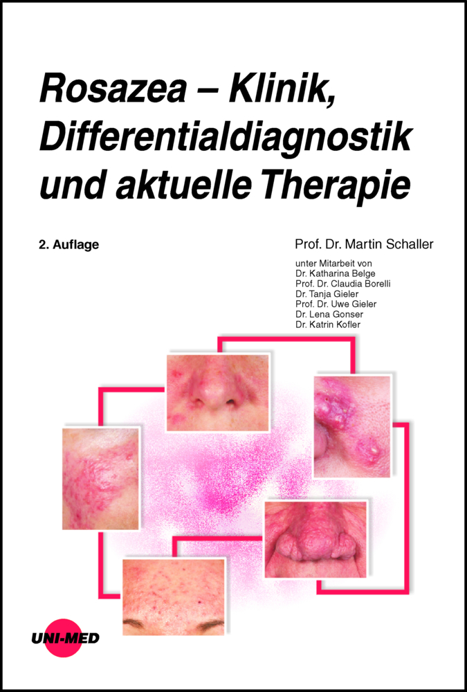 Rosazea - Klinik, Differentialdiagnostik und aktuelle Therapie main product photo