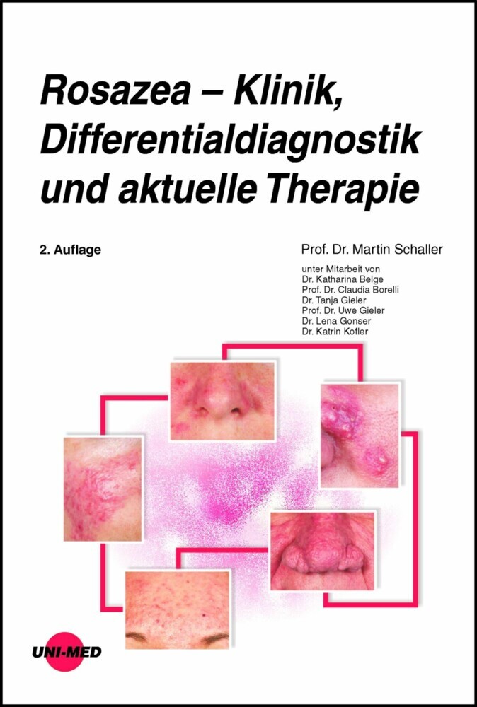 Rosazea - Klinik, Differentialdiagnostik und aktuelle Therapie main product photo