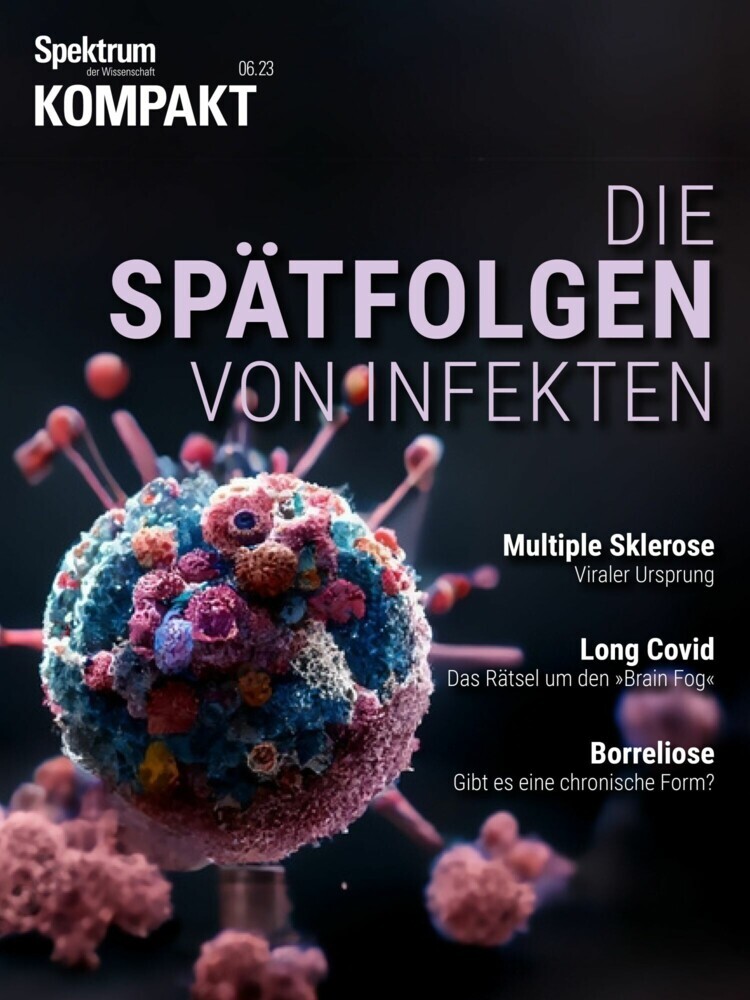 Spektrum Kompakt - Die Spätfolgen von Infekten main product photo