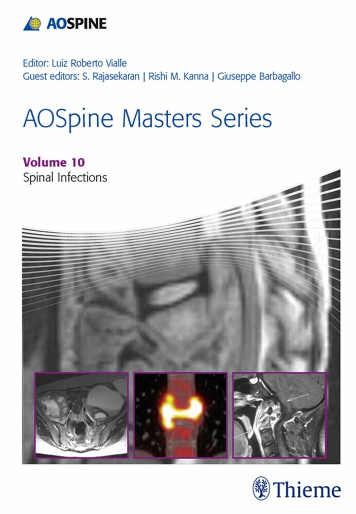 AOSpine Masters Series, Volume 10: Spinal Infections main product photo