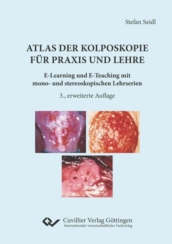 Atlas der Kolposkopie für Praxis und Lehre main product photo