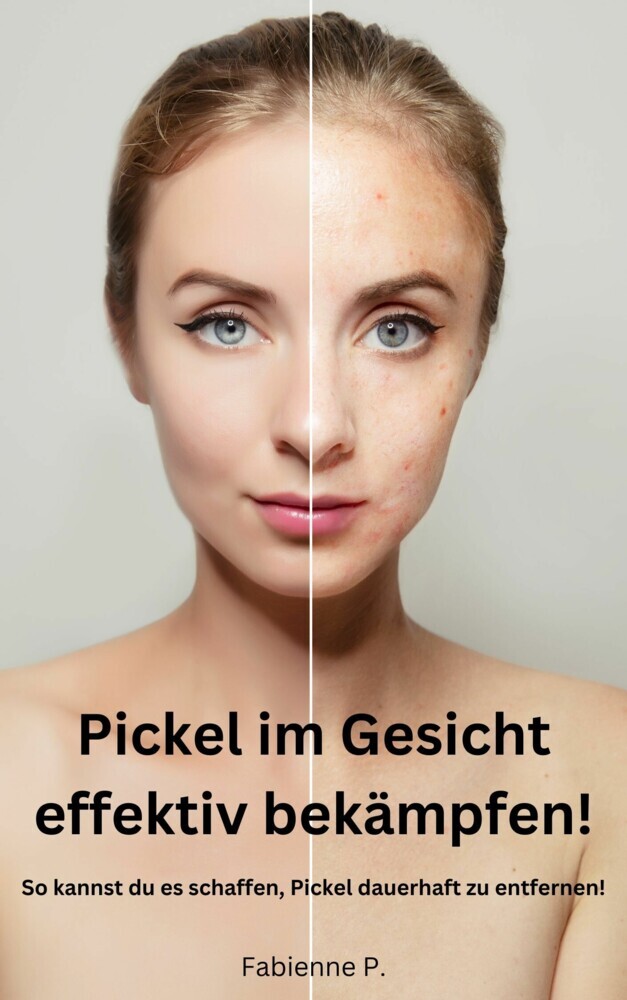 Pickel im Gesicht effektiv bekämpfen! main product photo