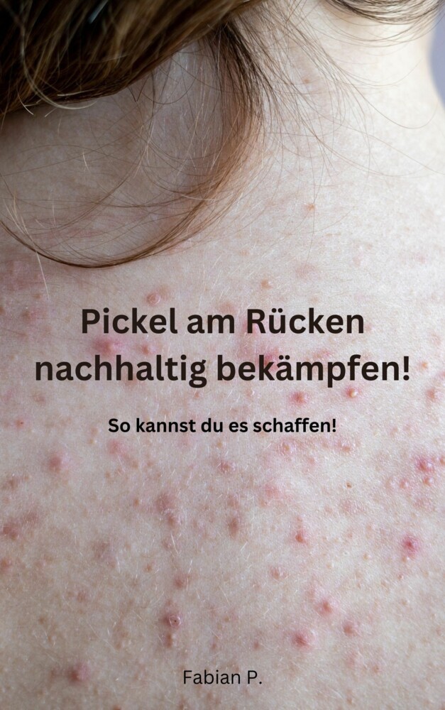 Pickel am Rücken nachhaltig bekämpfen! main product photo