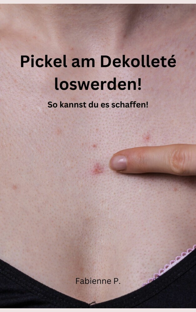 Pickel am Dekolleté loswerden! main product photo