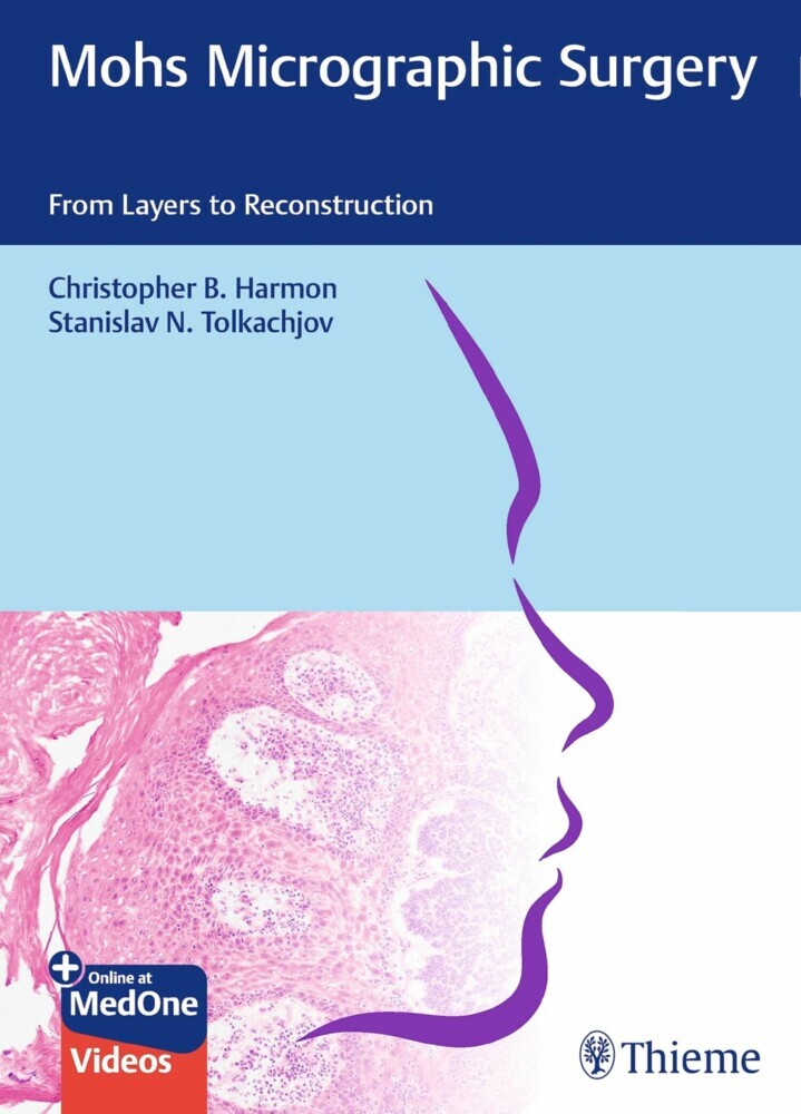 Mohs Micrographic Surgery: From Layers to Reconstruction main product photo