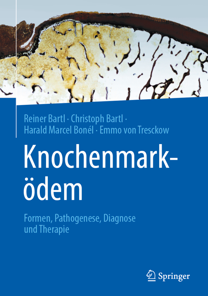 Knochenmarködem main product photo