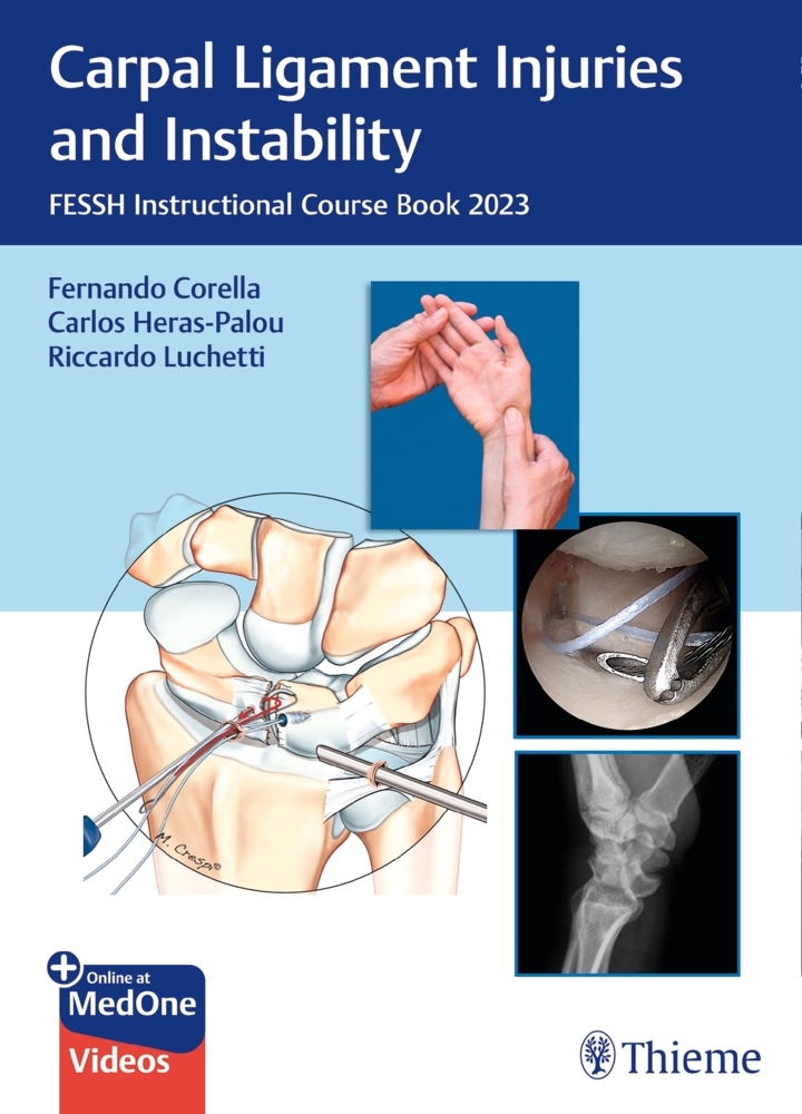 Carpal Ligament Injuries and Instability main product photo