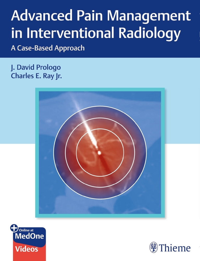 Advanced Pain Management in Interventional Radiology main product photo