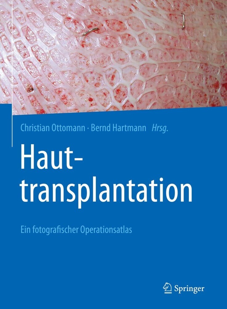 Hauttransplantation main product photo