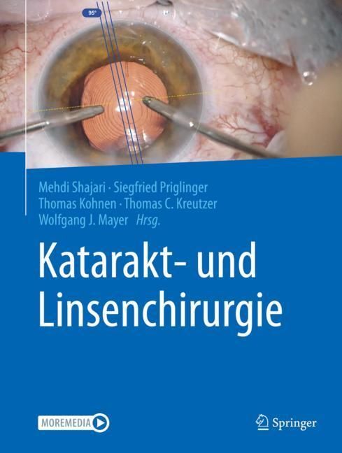 Katarakt- und Linsenchirurgie main product photo