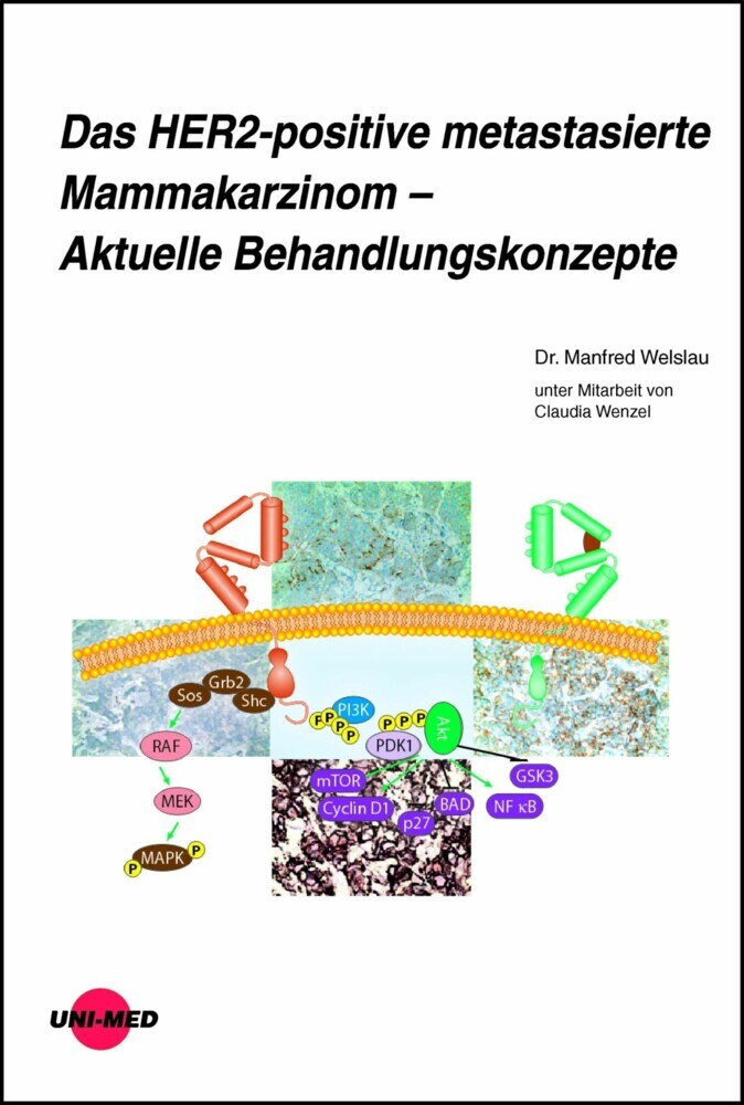 Das HER2-positive metastasierte Mammakarzinom - Aktuelle Behandlungskonzepte main product photo