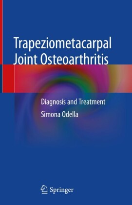 Trapeziometacarpal Joint Osteoarthritis