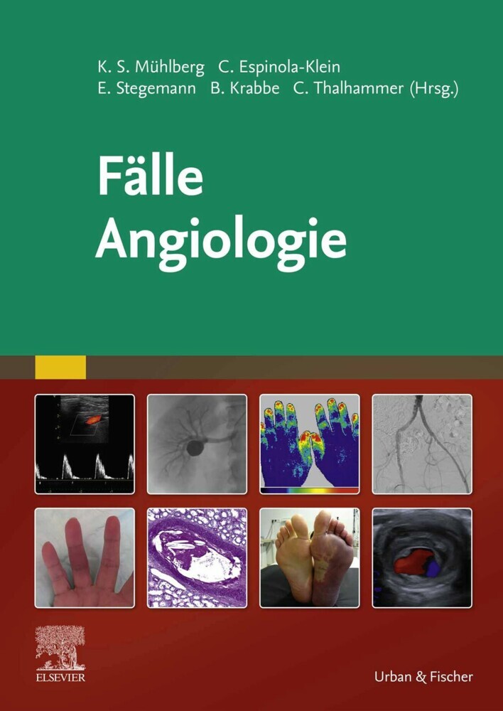 Fälle Angiologie main product photo