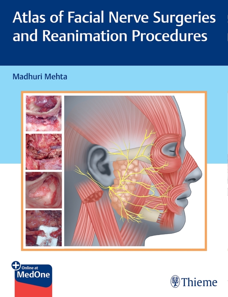 Atlas of Facial Nerve Surgeries and Reanimation Procedures main product photo