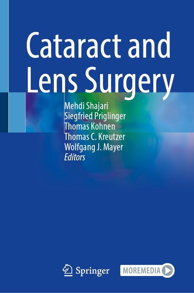 Cataract and Lens Surgery main product photo