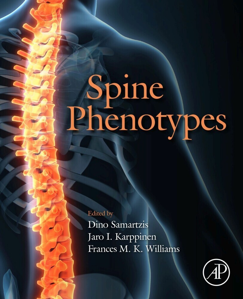 Spine Phenotypes main product photo
