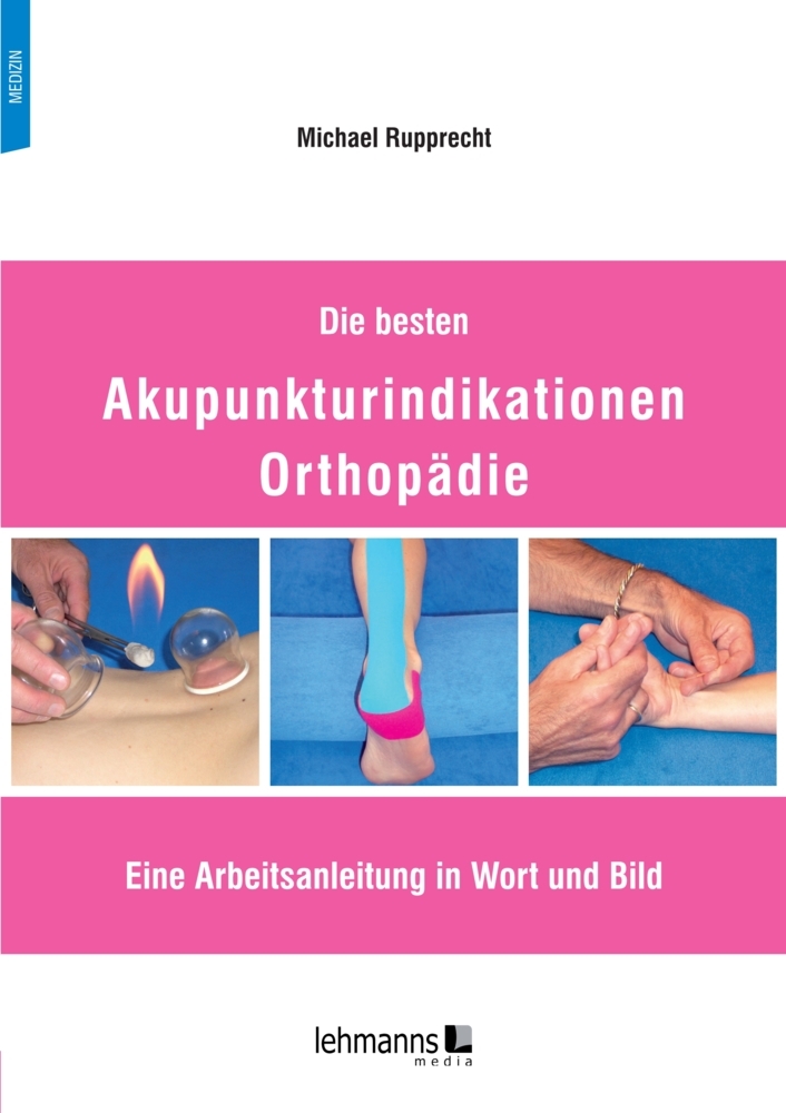 Die besten Akupunkturindikationen Orthopädie main product photo