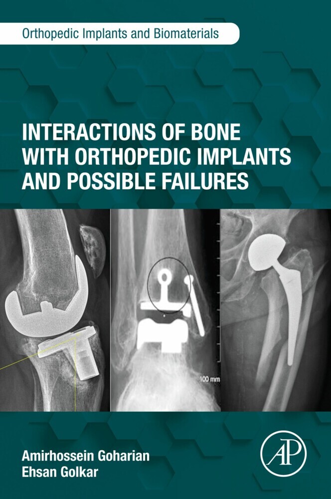 Interactions of Bone with Orthopedic Implants and Possible Failures main product photo