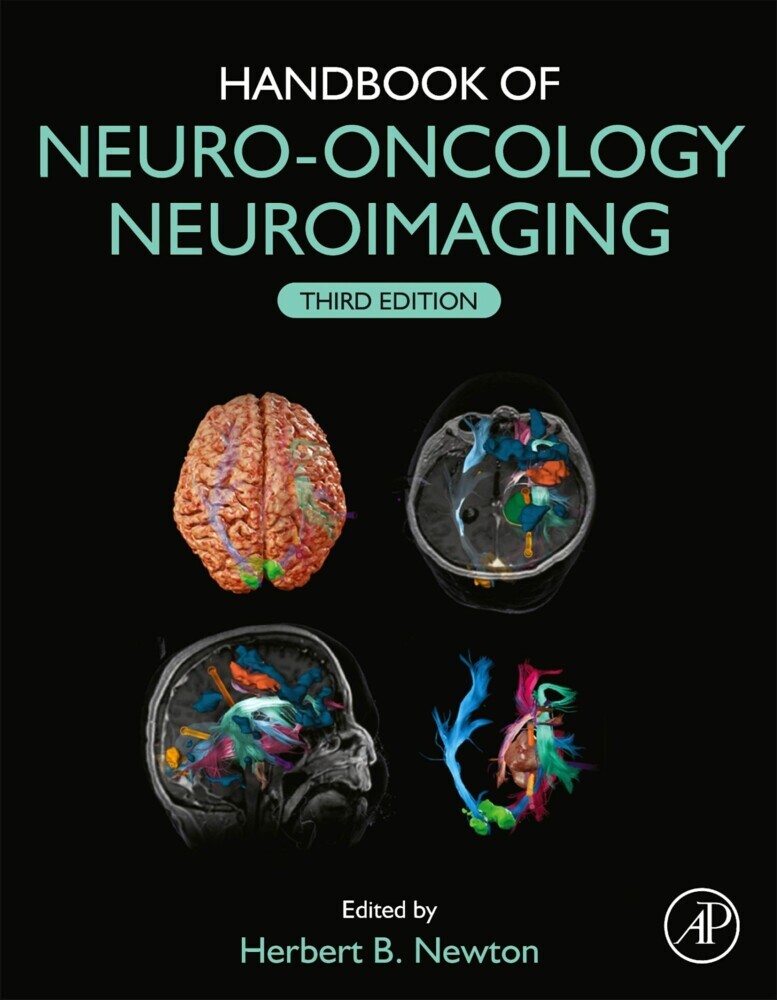 Handbook of Neuro-Oncology Neuroimaging main product photo