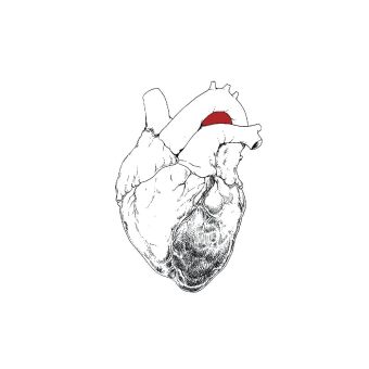 The Beggar, 2 Audio-CD (Limited Edition)