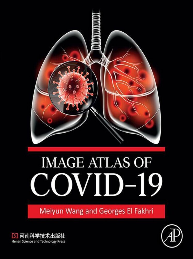 Image Atlas of COVID-19 main product photo