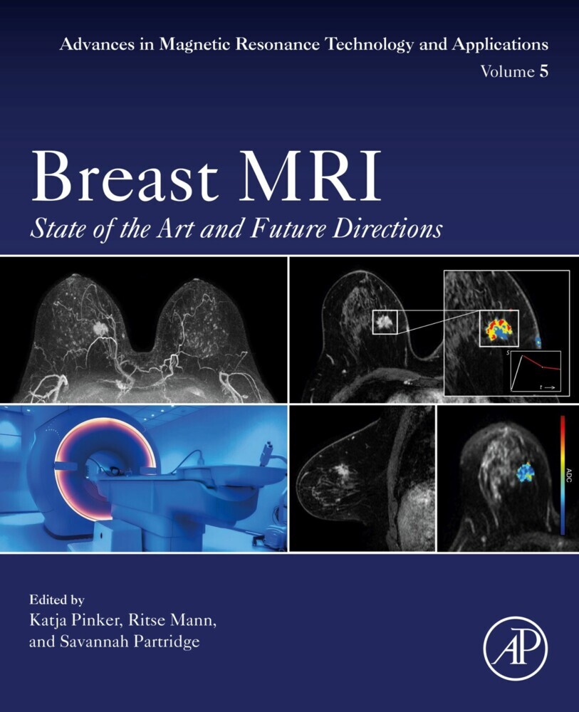 Breast MRI main product photo