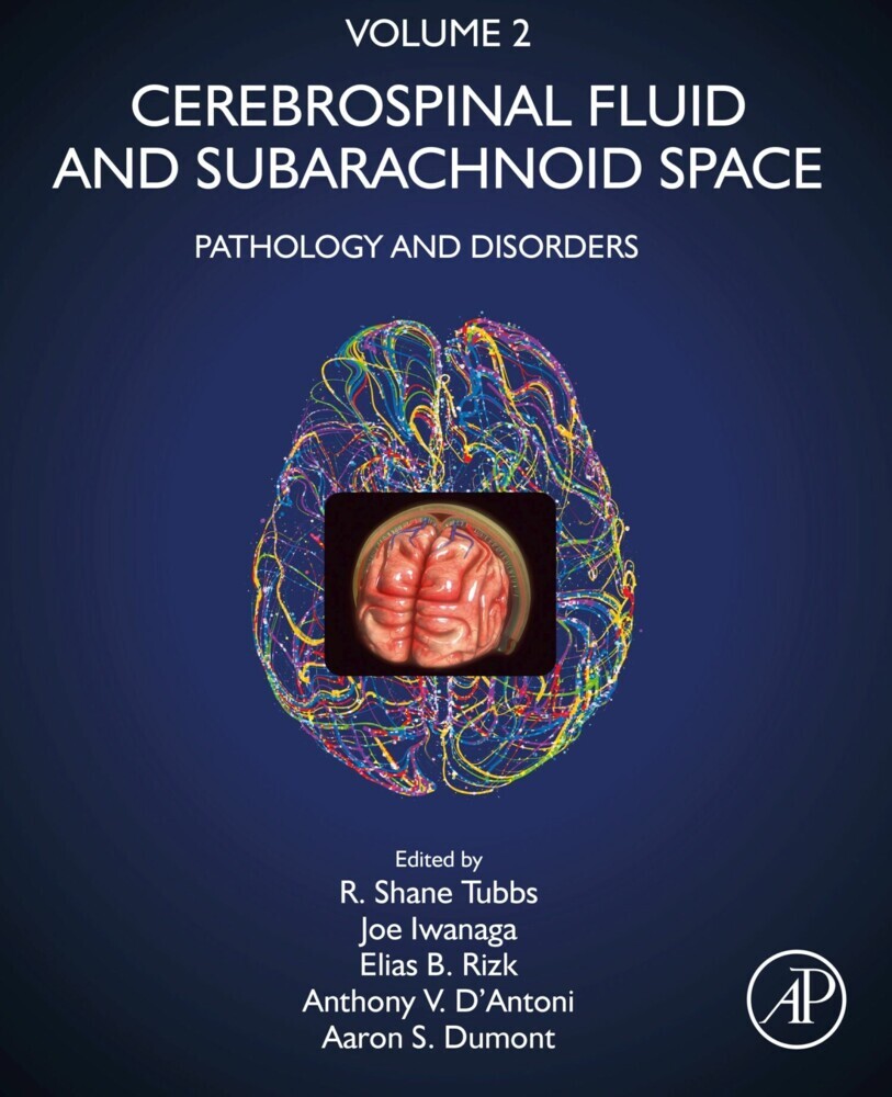 Cerebrospinal Fluid and Subarachnoid Space main product photo