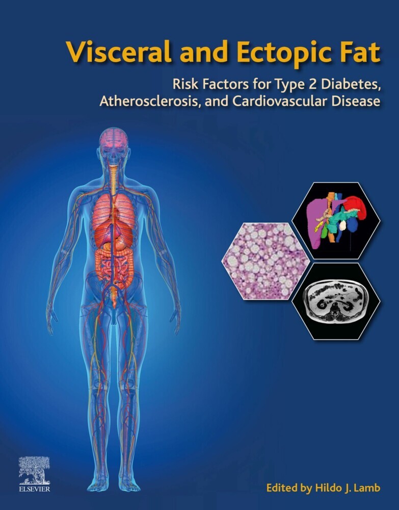 Visceral and Ectopic Fat main product photo