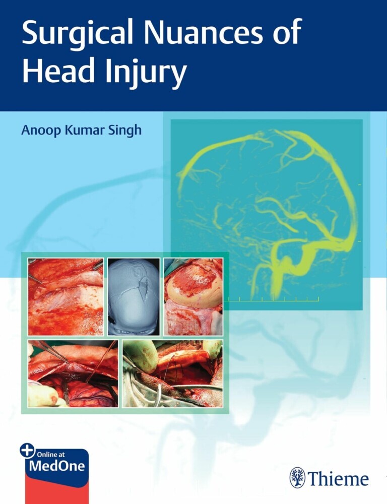 Surgical Nuances of Head Injury main product photo