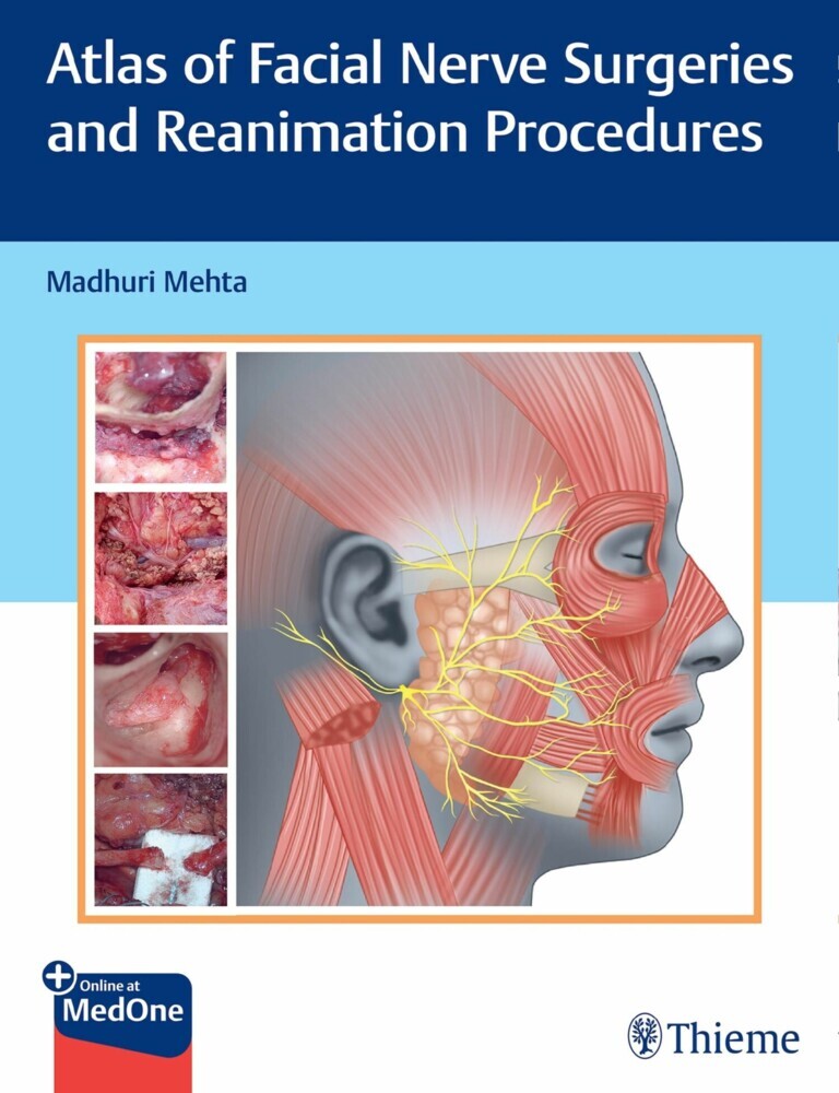 Atlas of Facial Nerve Surgeries and Reanimation Procedures main product photo
