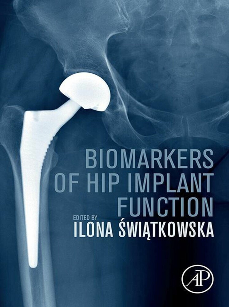 Biomarkers of Hip Implant Function main product photo