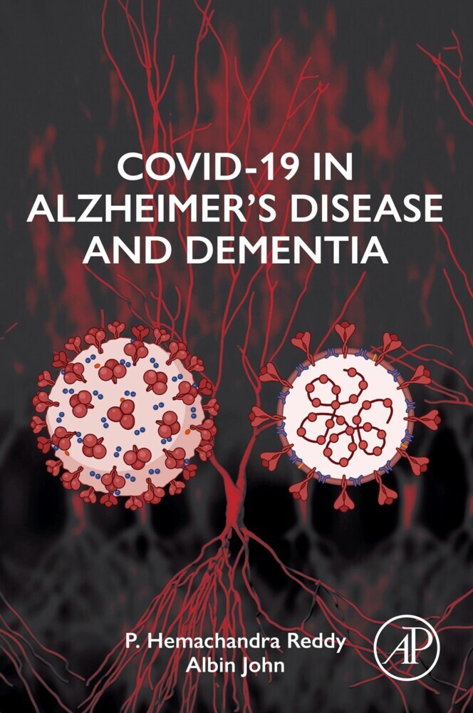 COVID-19 in Alzheimer's Disease and Dementia main product photo