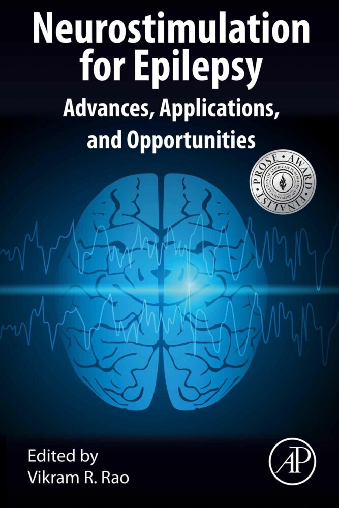 Neurostimulation for Epilepsy main product photo