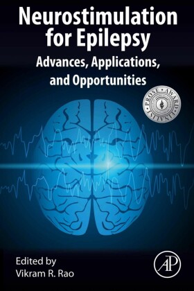 Neurostimulation for Epilepsy