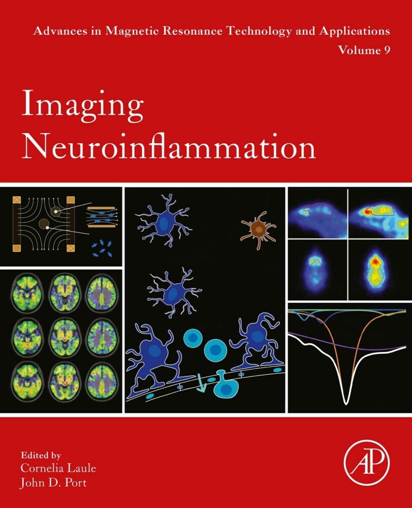 Imaging Neuroinflammation main product photo