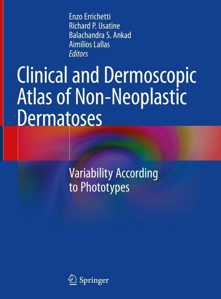 Clinical and Dermoscopic Atlas of Non-Neoplastic Dermatoses main product photo