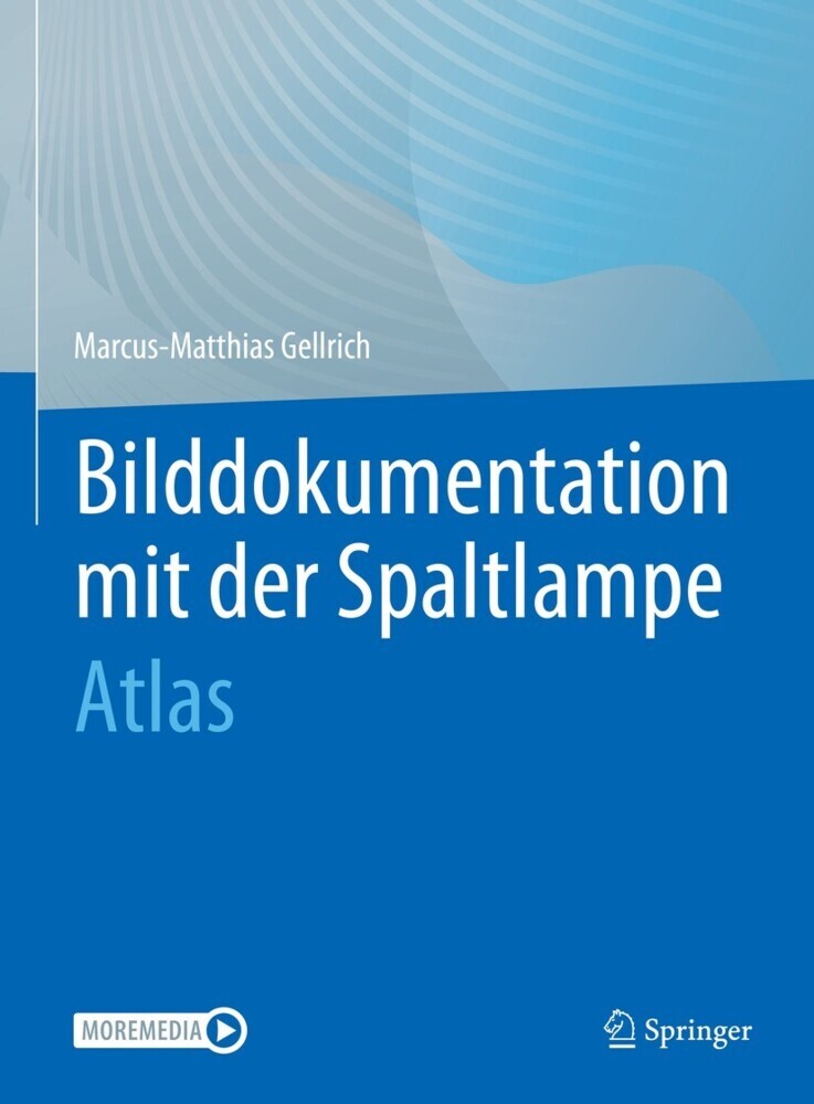Bilddokumentation mit der Spaltlampe main product photo