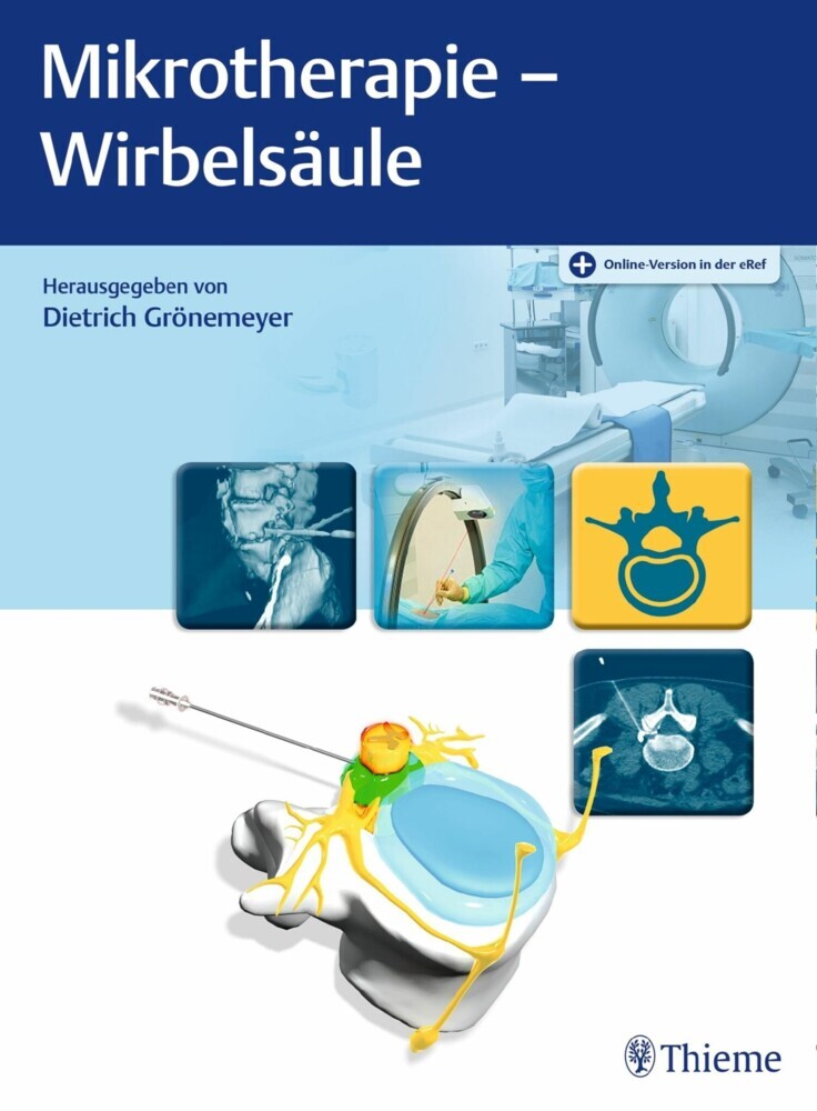 Mikrotherapie - Wirbelsäule main product photo