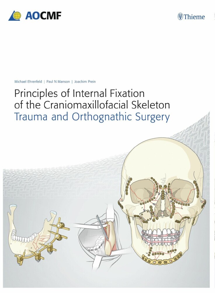 Principles of Internal Fixation of the Craniomaxillofacial Skeleton main product photo