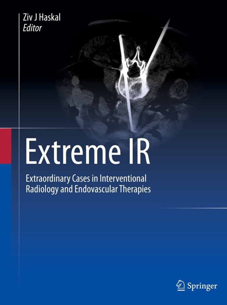 Extreme IR main product photo