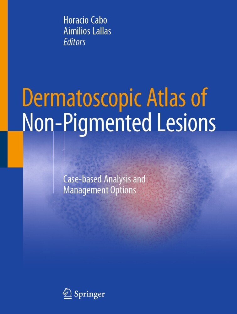 Dermatoscopic Atlas of Non-Pigmented Lesions main product photo