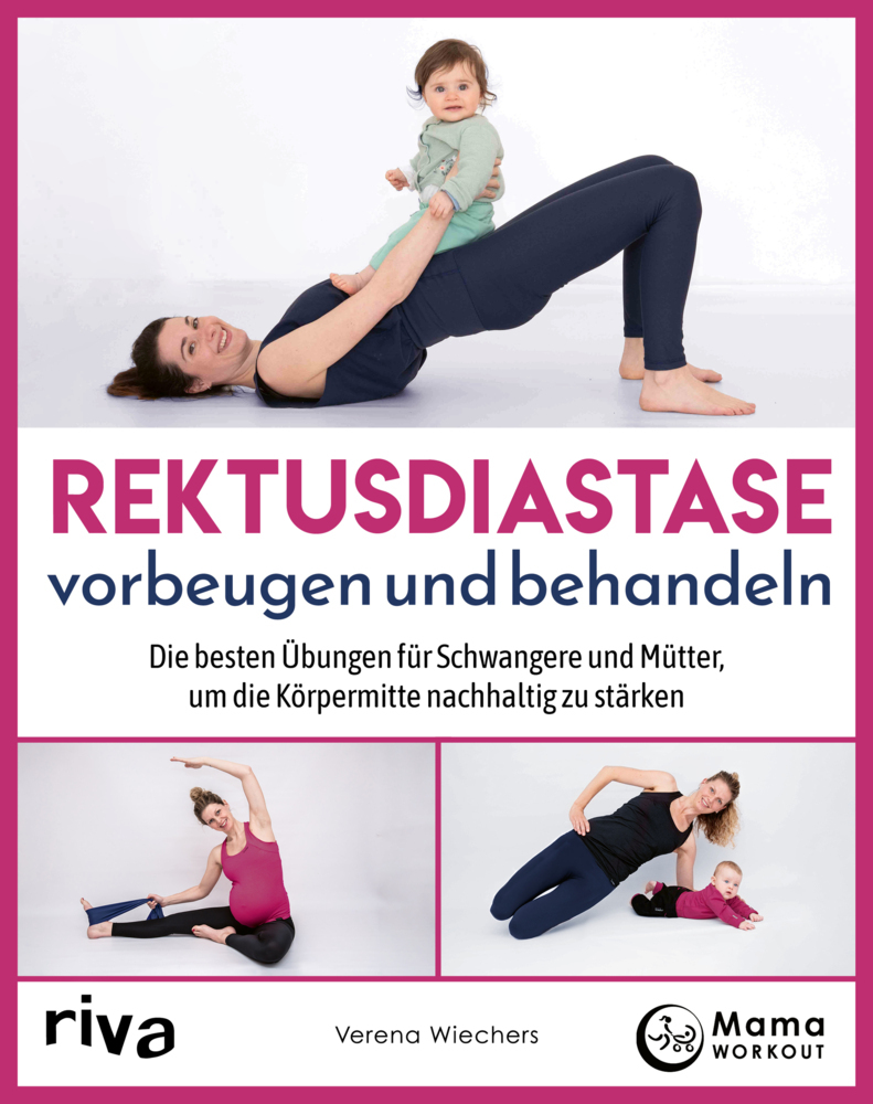 Rektusdiastase vorbeugen und behandeln main product photo