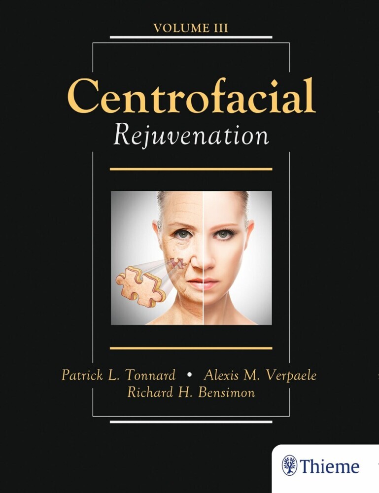 Centrofacial Rejuvenation main product photo