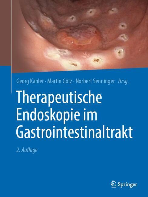 Therapeutische Endoskopie im Gastrointestinaltrakt main product photo