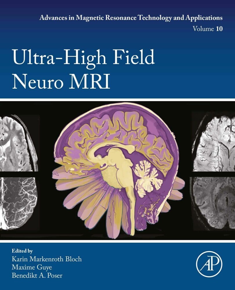 Ultra-High Field Neuro MRI main product photo
