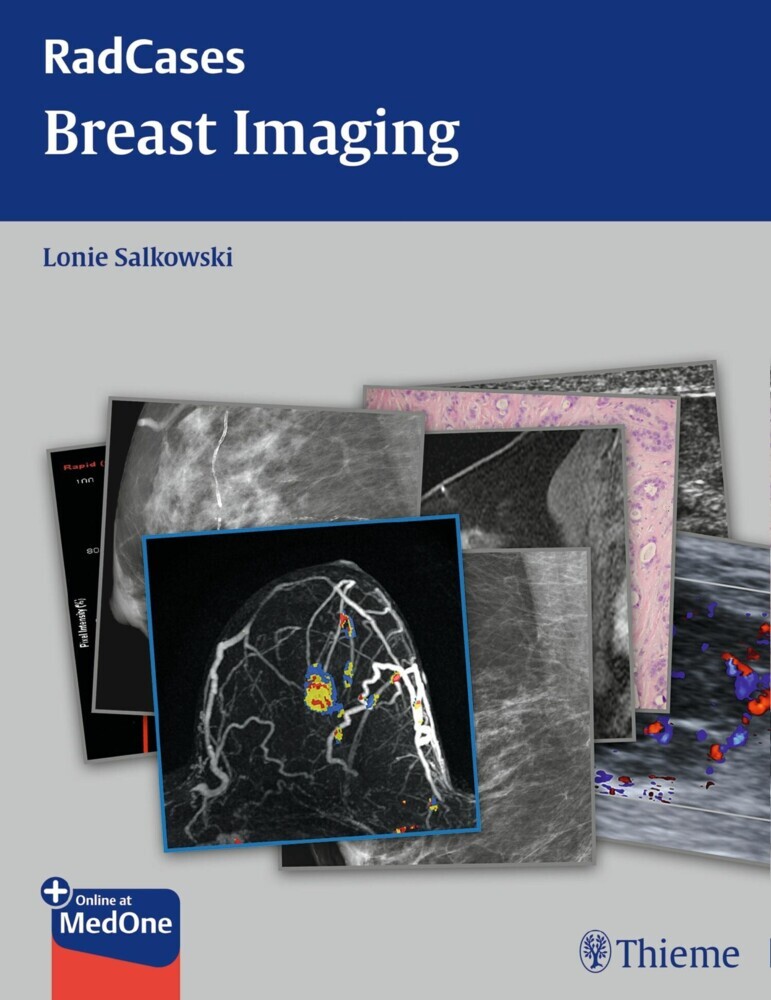 Radcases Breast Imaging main product photo