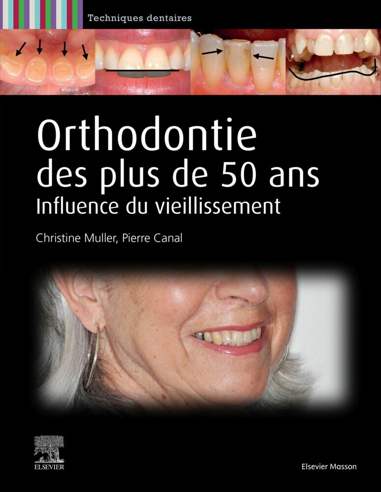 Orthodontie des plus de 50 ans main product photo