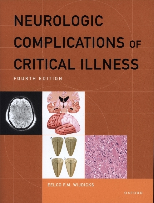 Neurologic Complications of Critical Illness main product photo