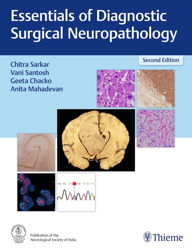Essentials of Diagnostic Surgical Neuropathology main product photo